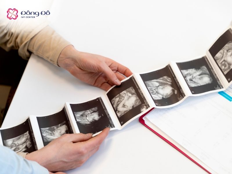 Khám tiền hôn nhân cung cấp thông tin để các cặp vợ chồng kế hoạch hóa sinh con chính xác hơn