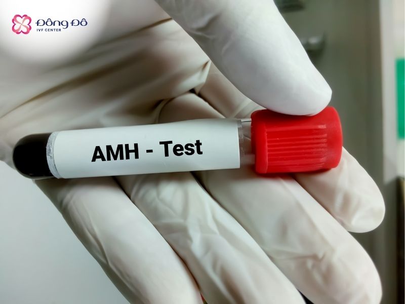 Xét nghiệm AMH đóng vai trò quan trọng trong đánh giá dự trữ buồng trứng - hay chính là cơ hội làm mẹ của phụ nữ