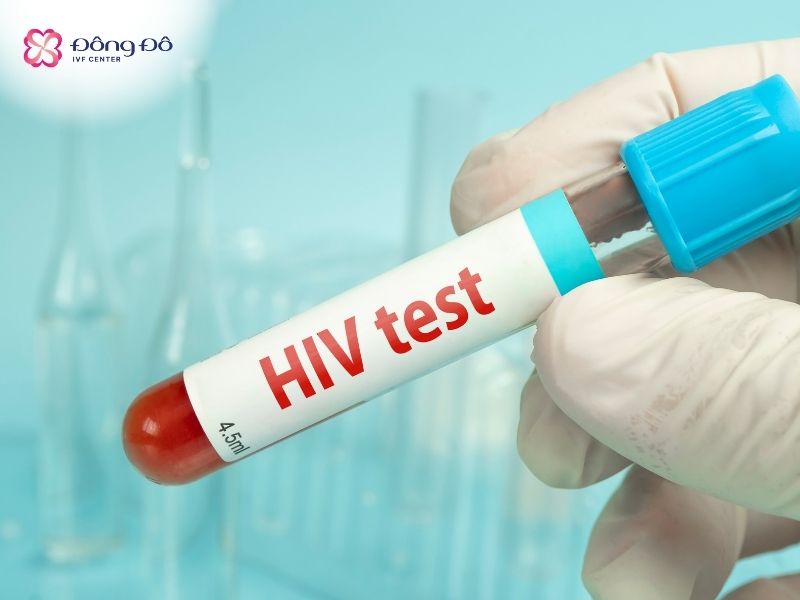 Xét nghiệm HIV cũng nằm trong bộ xét nghiệm bệnh lây truyền qua đường tình dục
