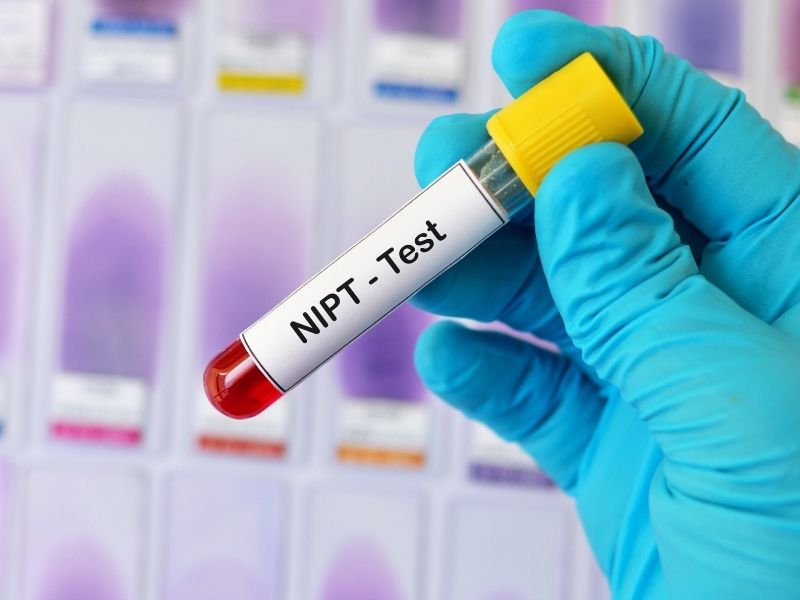 Xét nghiệm NIPT là xét nghiệm cần thiết cho thai kỳ