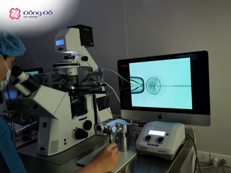 Trường hợp tinh trùng yếu được thực hiện Piezo ICSI tại Đông Đô IVF Center