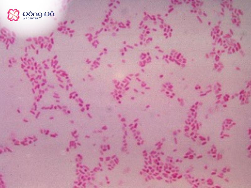 Các trực khuẩn Gram âm đường ruột dưới kính kiển vi